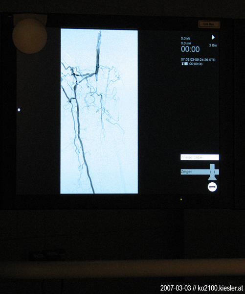 Cardiac CT 2